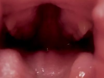 Katelyn brooks mouth (not mine)