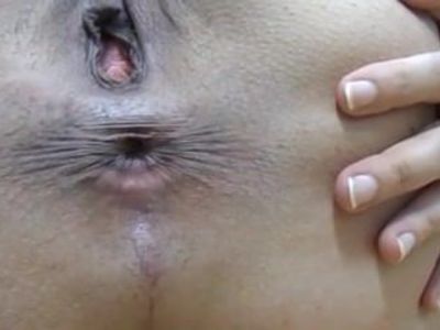 40-year old butt and asshole on display