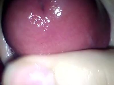 Look At The Head On That