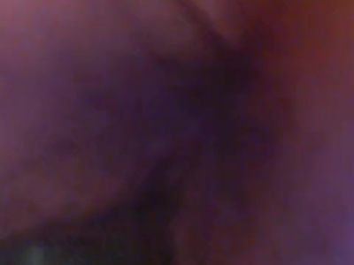 CLOSE UP Endoscope Asshole Hairy MILF Mature
