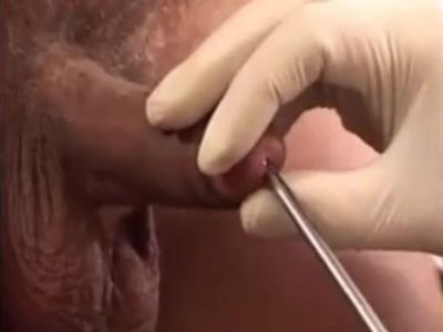 Mature Medical Exam
